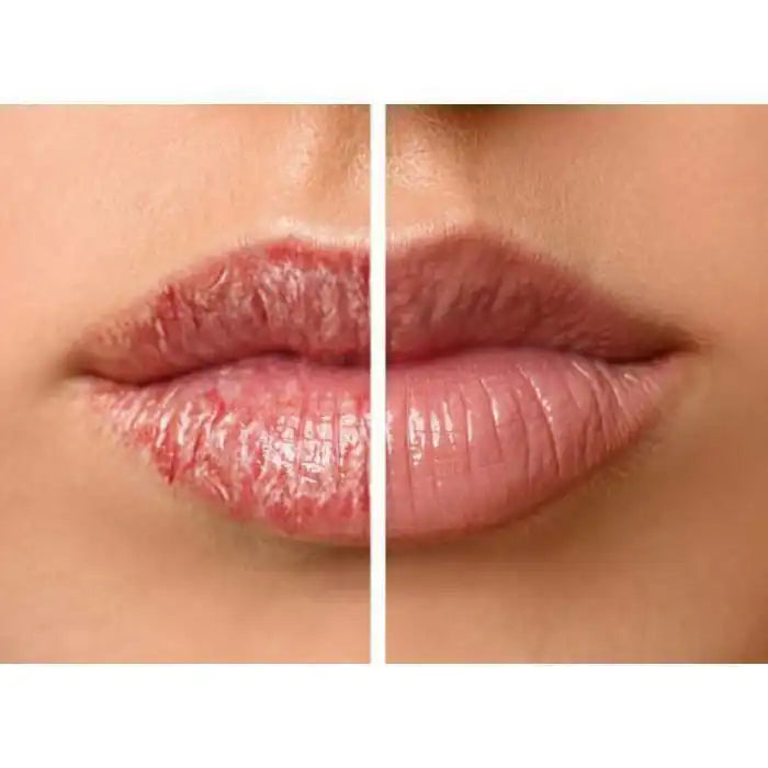 Celvess Cosmetic D-BIOTIC very repairing lip balm in a 15ml tube, designed to soothe and hydrate chapped lips.